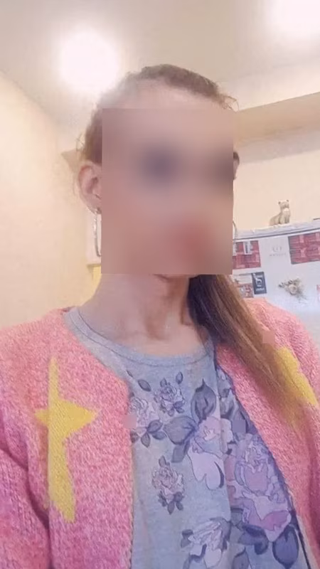 Masaz prostaty